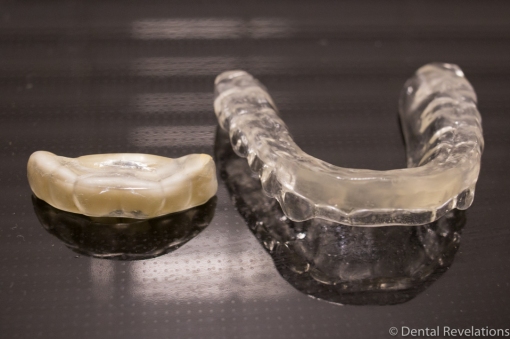 Dental Revelations Blog-2