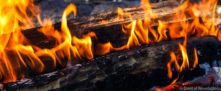 dental-revelations-blog